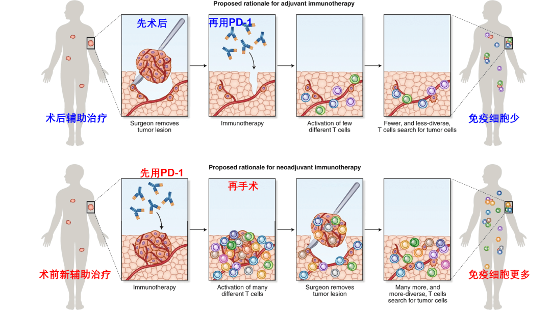 PD-1神药：早用早好还是晚用好？