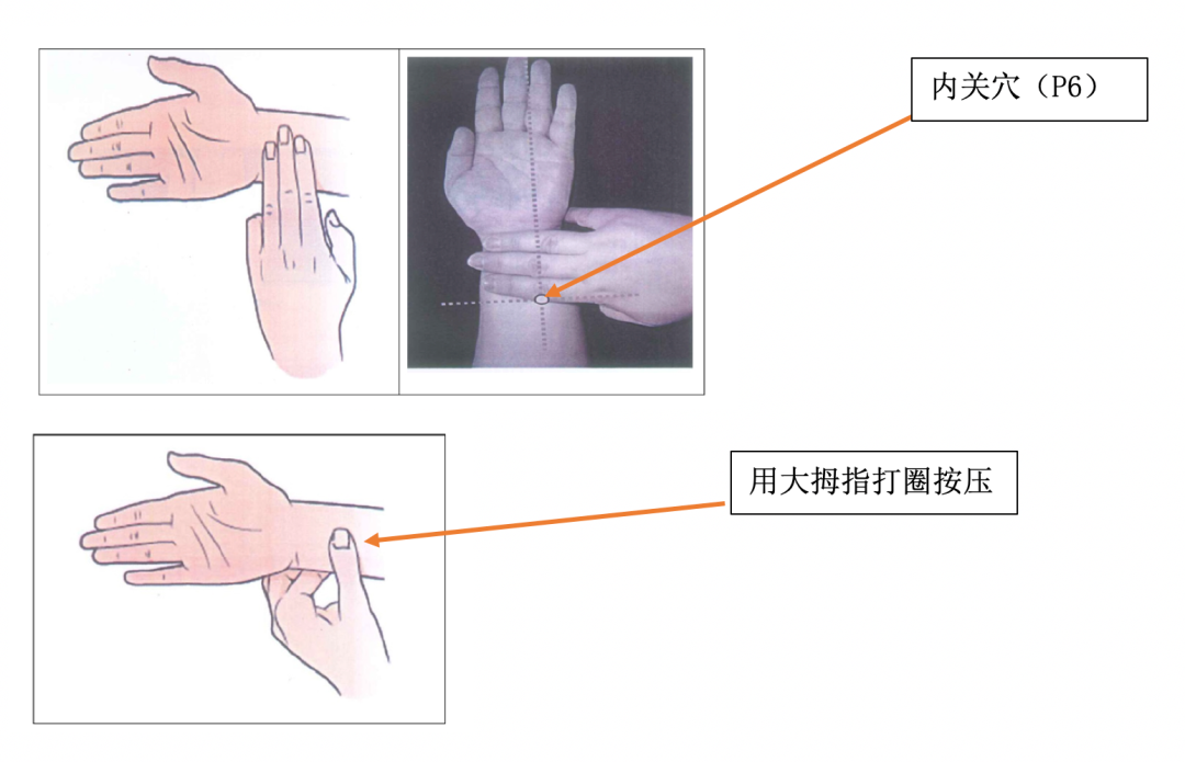 癌症治疗期间间恶心呕吐怎么办？