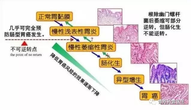 浅表性胃炎距离胃癌有多远？应该怎么治疗？