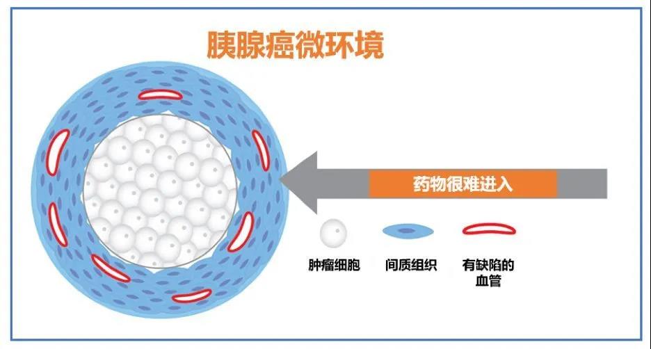 胰腺癌为什么特别难治？希望在哪里？