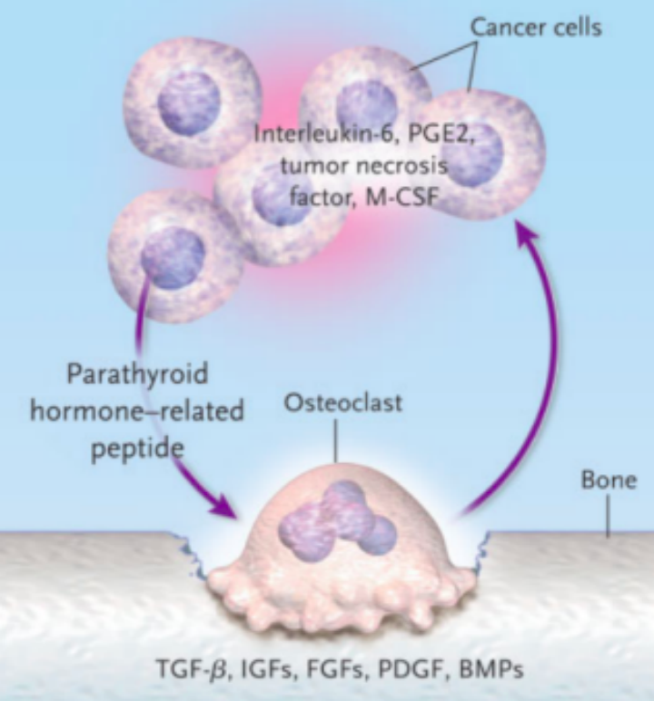 癌症骨转移及其治疗药物