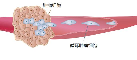 火爆癌友圈的CTC检查，真有这么神奇？