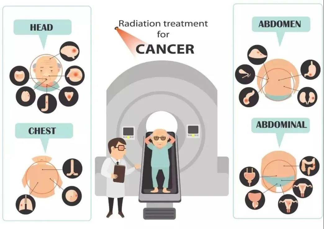 放疗：每天照射1次，每周照射5次，这是什么道理？! | 放疗常识第10期