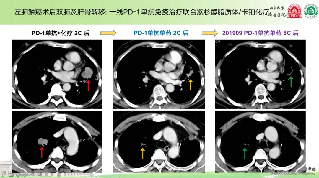 化疗科李际盛荣获中国临床肿瘤学会(CSCO)肺癌临床治疗中青年医师