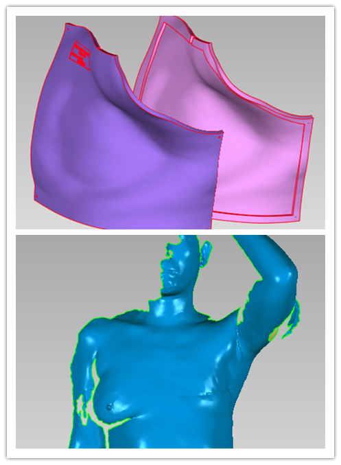 3D打印技术与放疗技术相结合——辽宁省肿瘤医院乳腺放疗病区成功