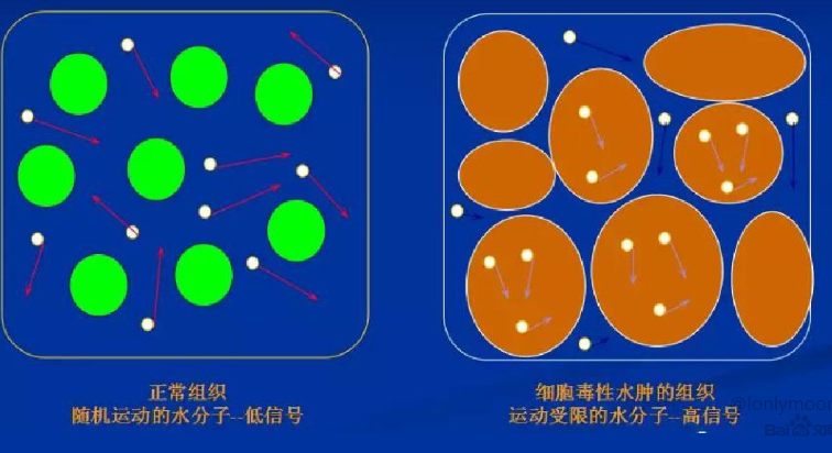 据说类PET和PET-CT一样，检查费用还便宜？