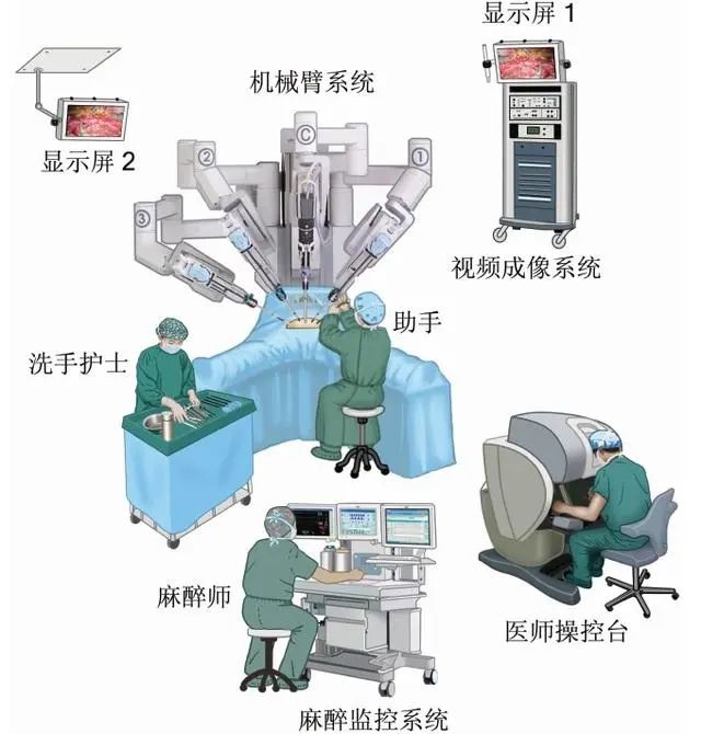 机器人 vs 腹腔镜，手术该选哪个？