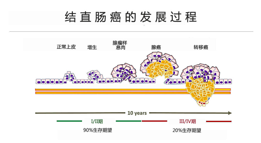 结肠息肉没切变肠癌，医生提醒这些人肠镜筛查不能省