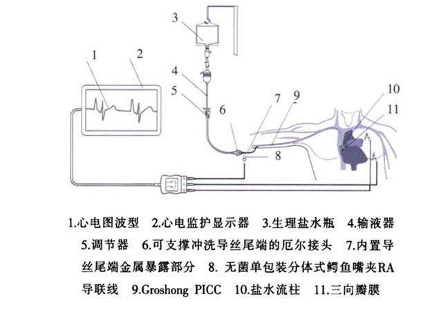 乳癌、手术、化疗……这次，孕妈妈的抗癌路又遇“辐射”难题！