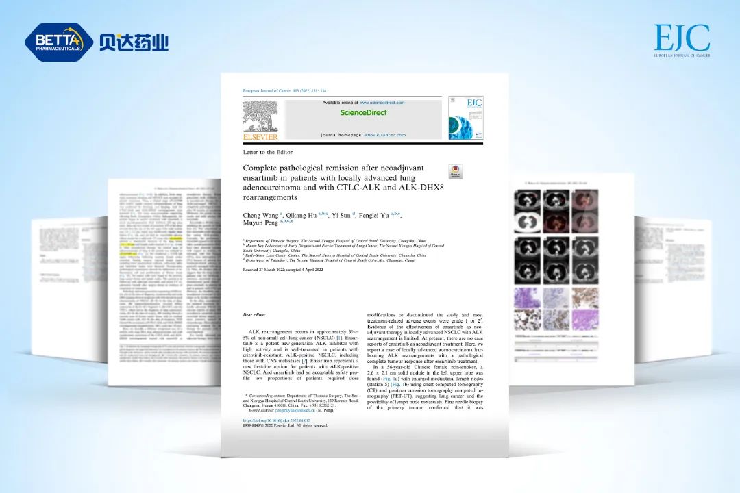 捷报！恩沙替尼新辅助探索治疗罕见ALK融合肺腺癌患者实例发表于Eur