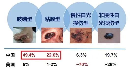 谈谈常见的黑色素瘤靶向药之维莫非尼