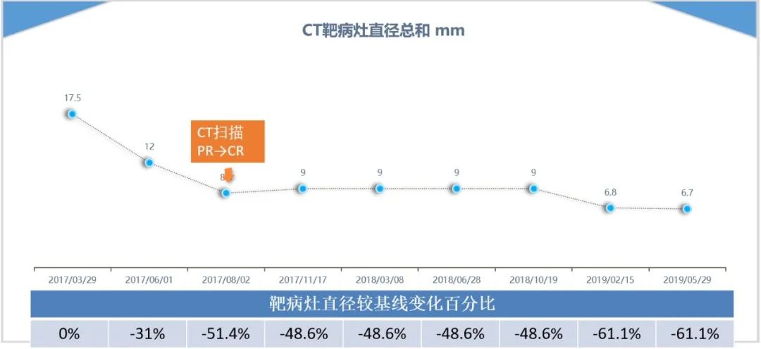 mHSPC患者幸运入组TITAN研究，阿帕他胺带来疗效超越 | 病例分享