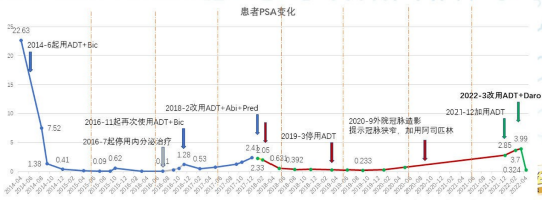 达罗他胺搭档ADT强效安心降低PSA，3个月PSA降幅98.3%