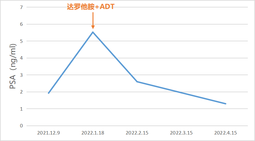  强效对抗PSA，安全可控，达罗他胺或为非转移阶段前列腺癌患者优选