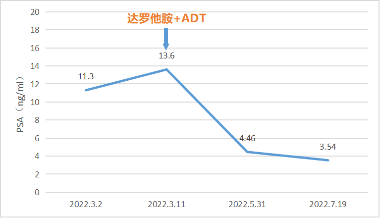 达罗他胺搭档ADT，强效安心降低PSA，开启双诺时代