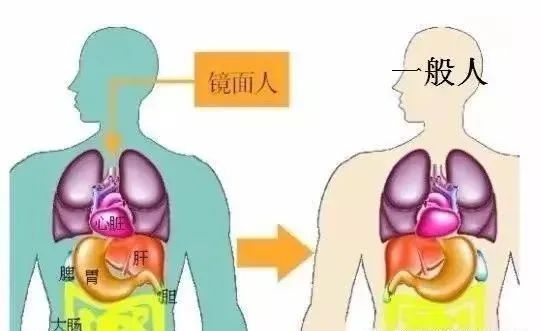 辽宁省肿瘤医院医视点|逆向反切罕见“镜面人”肺癌“定时炸弹”