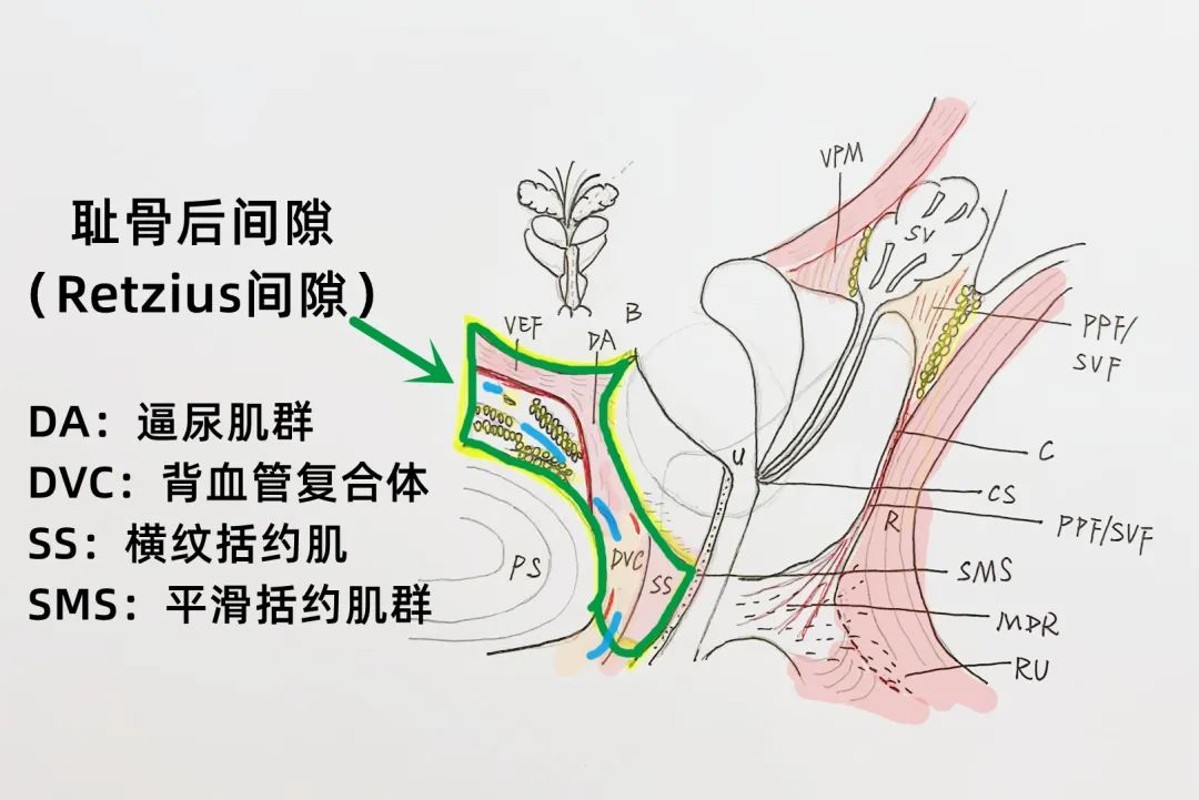 改善术后尿失禁！ 苏州大学附属第一医院完成苏州市首例保留耻骨后